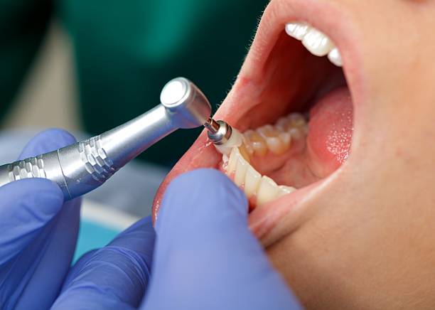 Oral Cancer Screening